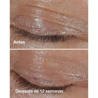 Clinique Smart Clinical Repair Eye Cream 15ml-202490 Clinique Smart Clinical Repair Eye Cream 15ml-202490 2
